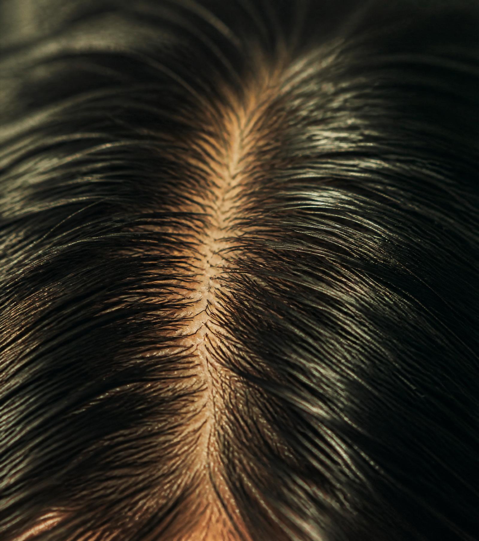 Hair & Scalp Analysis